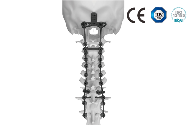 頸椎后路內固定系統