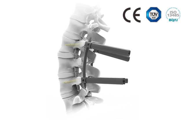 脊柱后路內固定系統-CTS微創